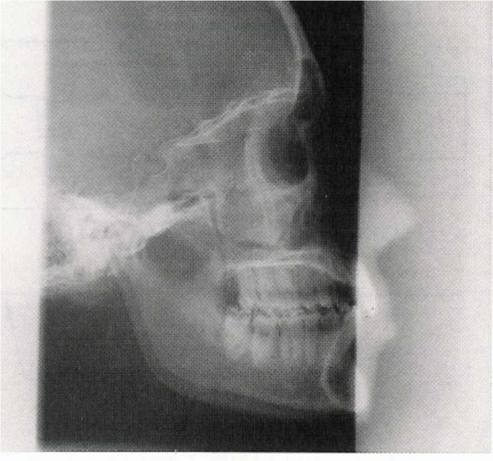 <p><span>–</span><span style="font-family: "Times New Roman";"><span>Refers to photons not produced at the focal spot of the anode</span></span></p><p><span>•</span><span style="font-family: "Times New Roman";"><span>tube housing</span></span></p><p><span>•</span><span style="font-family: "Times New Roman";"><span>evaporate tungsten on envelope </span></span></p>