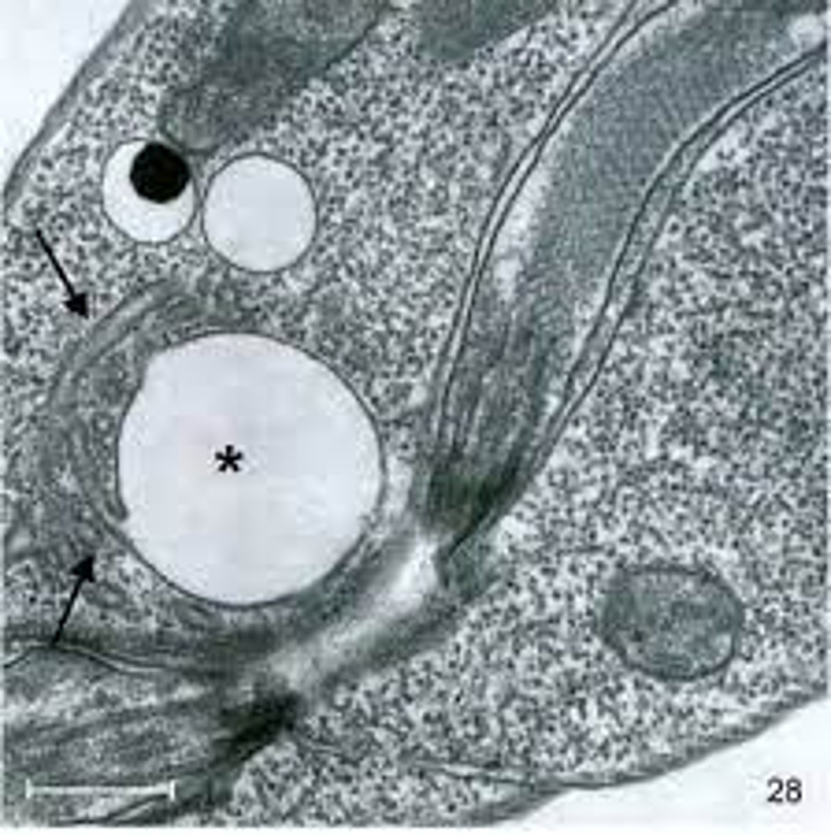 <p>Membrane surrounding a vacuole</p>