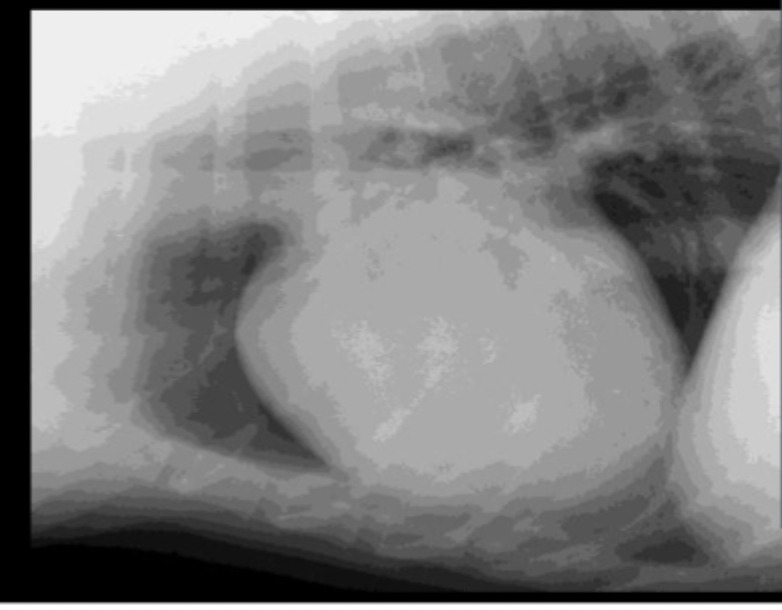<p>What part of the heart is enlarged on this lateral radiograph?</p>