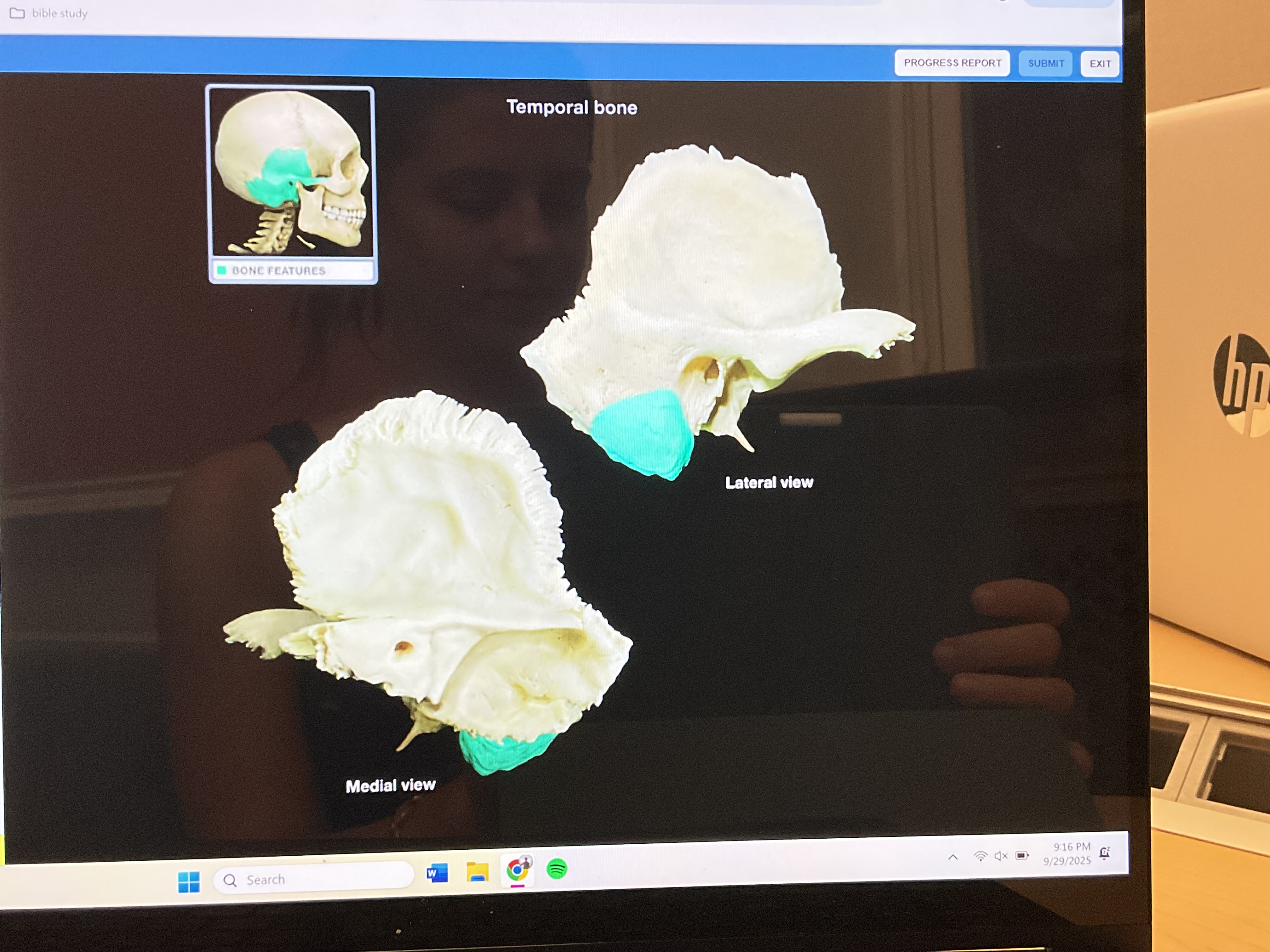 <p>Mastoid process</p>