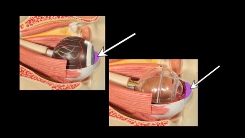 <p>(p.) of the anterior segment</p>