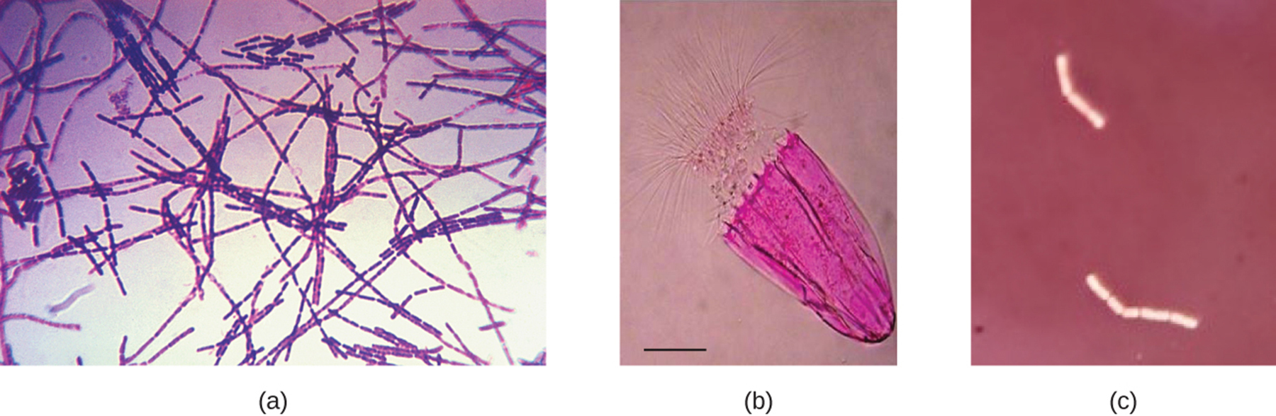 <p><strong>A:</strong> <strong>Crystal violet</strong>, a <strong>basic positive stain</strong>.</p>