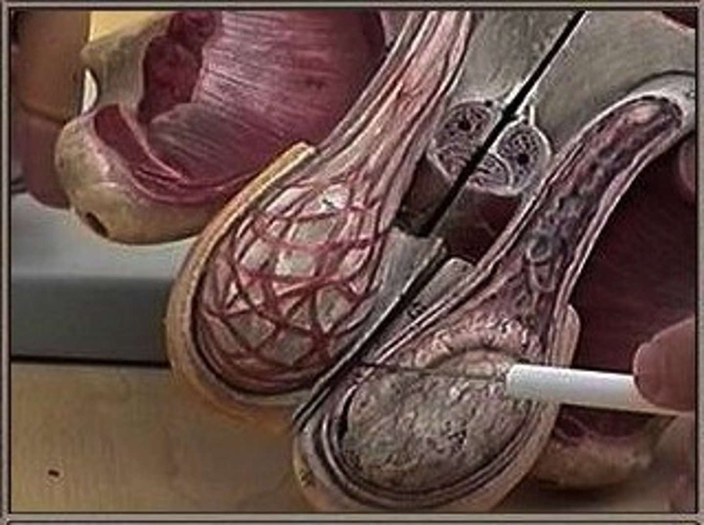 <p>Fx: divides the scrotum into two sacs</p>