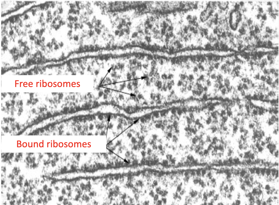 <ul><li><p>features</p></li><li><p><strong>80S</strong> (larger than in prokaryotes), ca.20nm​&nbsp;</p></li><li><p>No exterior membrane​</p></li><li><p>Free in the cytoplasm or bound to ER​</p></li><li><p>Composed of ribosomal RNA and protein</p></li><li><p>produced in the <strong>nucleolus of the nucleus​</strong></p></li><li><p>Appear as dark granules</p></li></ul><p></p><ul><li><p>functions</p></li><li><p>Produces <strong>proteins</strong> to function in the cytoplasm for use within the cell (enzymes)​</p></li></ul><p></p>