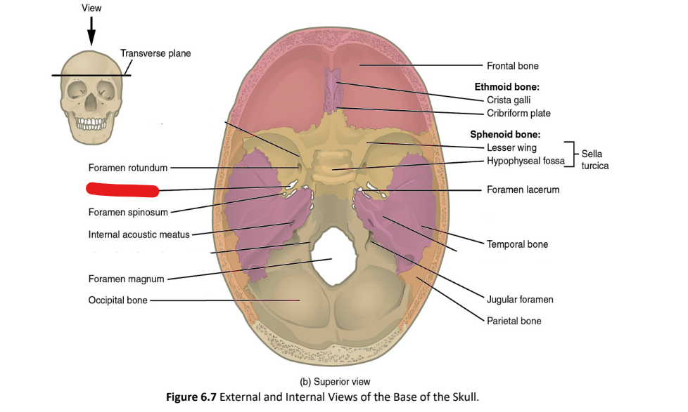 term image