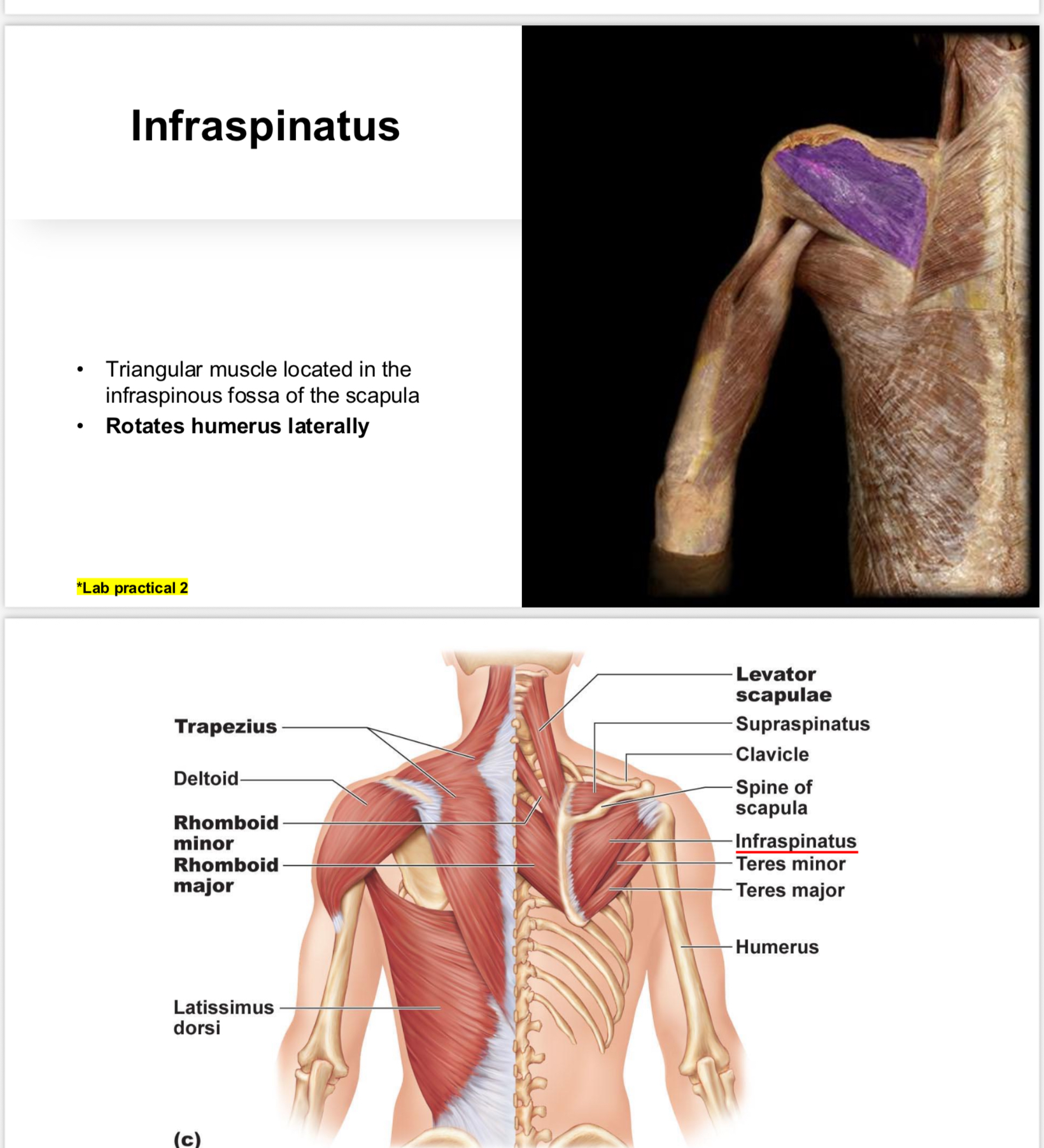 <p>Muscle that facilitates lateral rotation of the humerus.</p>