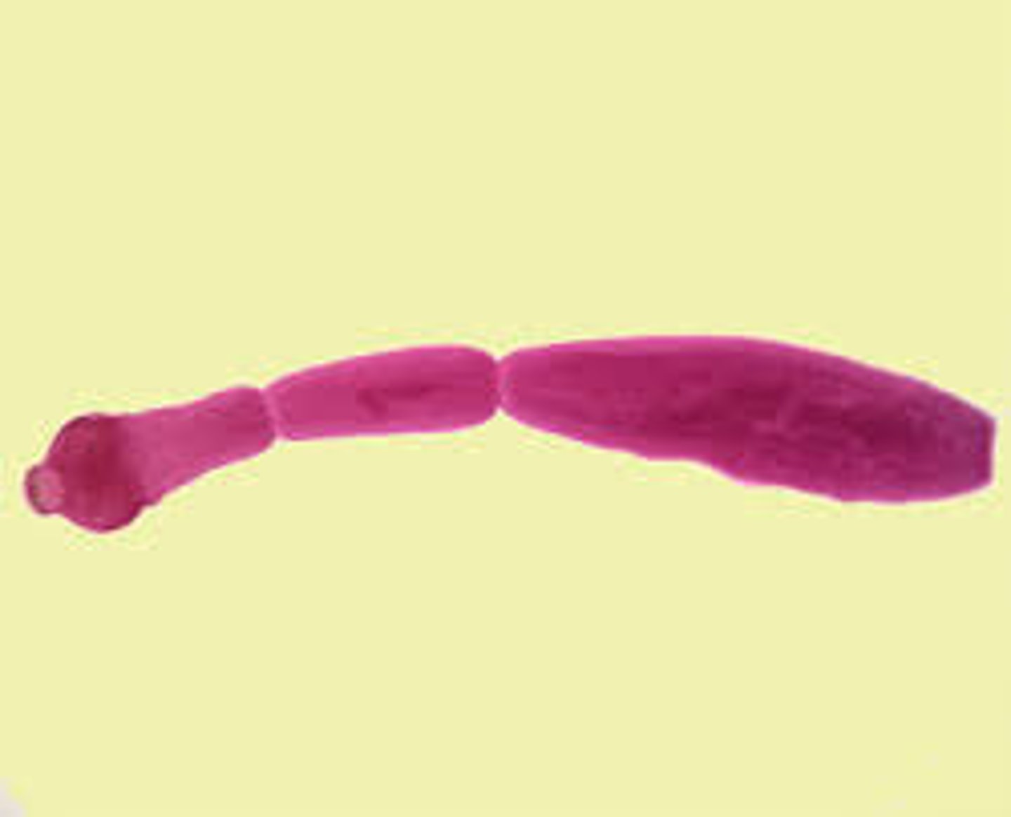 <p>Immature</p><p>Mature</p><p>Gravid</p><p>12-15 uterine branches in each</p>