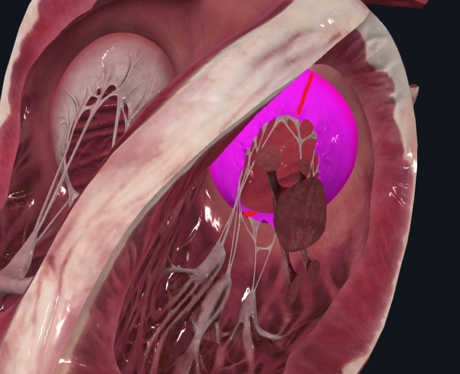 <p>Válvula auriculoventricular de lado izquierdo</p><p>Biscupidia</p><ul><li><p>Cerrada en sístole</p></li></ul><p></p>