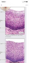 - Multiple layers of cells
- Apical cells are dead, flat
- Function- protection
FOUND- epidermis of skin