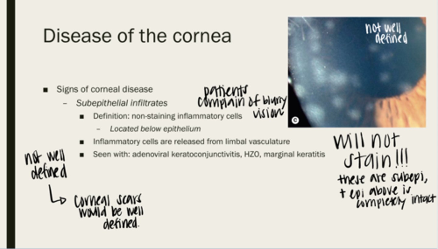 <p>Will subepithelial infiltrates stain?</p>