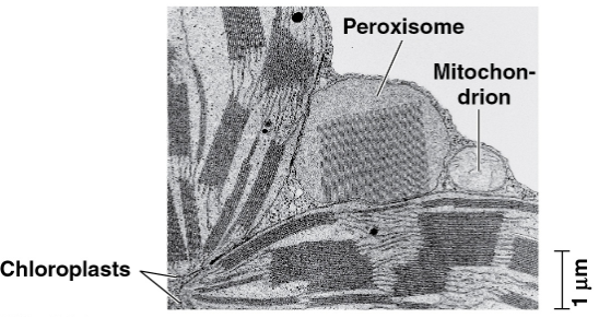 <p>Peroxisomes</p>