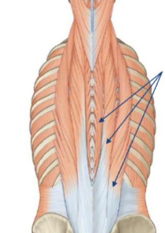 <p>intrinsic muscles on back </p>