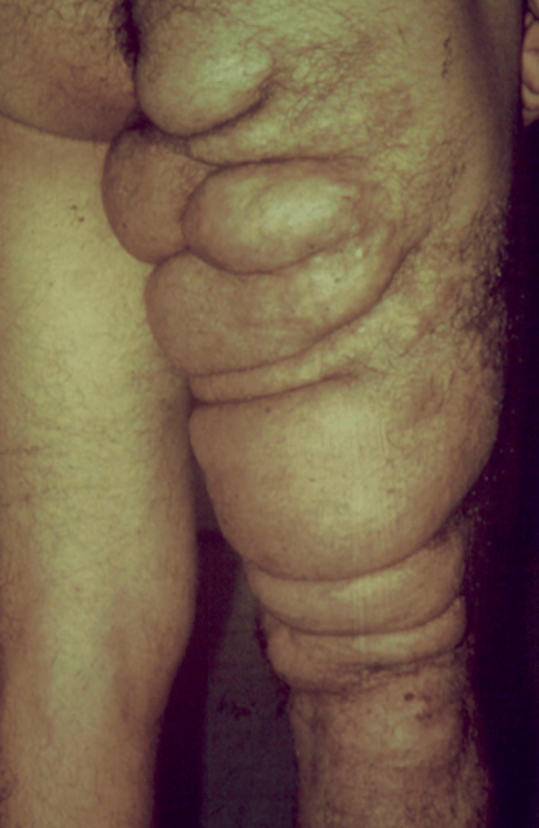 <p>What is the diagnosis?</p>