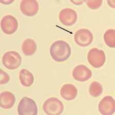 <p>What is the shape of this erythrocyte?</p>