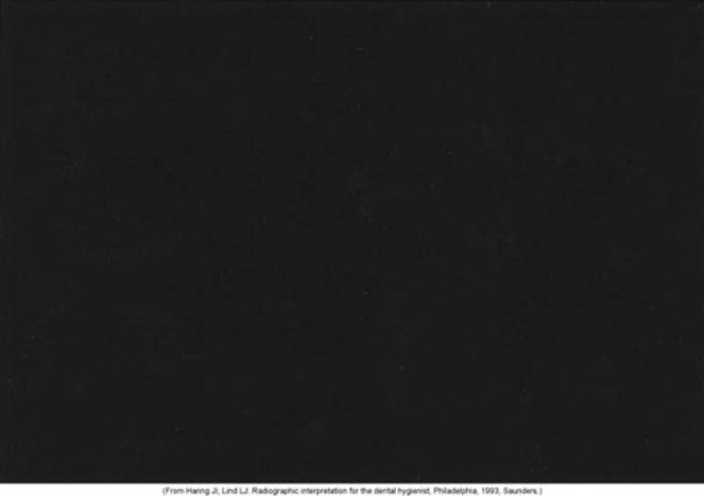 <p>Receptor</p><p>Occurs only with film</p><p>Appearance</p><p>The image appears black.</p><p>Cause</p><p>The film was exposed to white light.</p><p>Correction</p><p>Do not unwrap in a room with white light.</p><p>Check the darkroom for light leaks.</p><p>Turn off all lights in the darkroom except the safelight.</p>