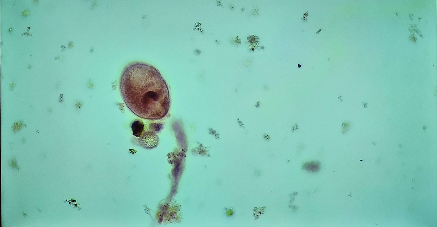 <p><span data-name="microscope" data-type="emoji">🔬</span><span data-name="petri_dish" data-type="emoji">🧫</span><strong><span> </span>Na podstawie zdjęcia preparatu:</strong></p><p></p><ul><li><p><span data-name="book" data-type="emoji">📖</span><span> </span>rozpoznaj gatunek pasożyta;</p></li></ul><p></p><ul><li><p><span data-name="recycle" data-type="emoji">♻</span><span> </span>rozpoznaj wszystkie formy rozwojowe;</p></li></ul><p></p><ul><li><p><span data-name="microbe" data-type="emoji">🦠</span><span> </span>wskaż organelle i cechy charakterystyczne dla danego gatunku;</p></li></ul><p></p><ul><li><p><span data-name="mask" data-type="emoji">😷</span><span> </span>nazwij chorobę, którą pasożyt wywołuje.</p></li></ul><p></p>