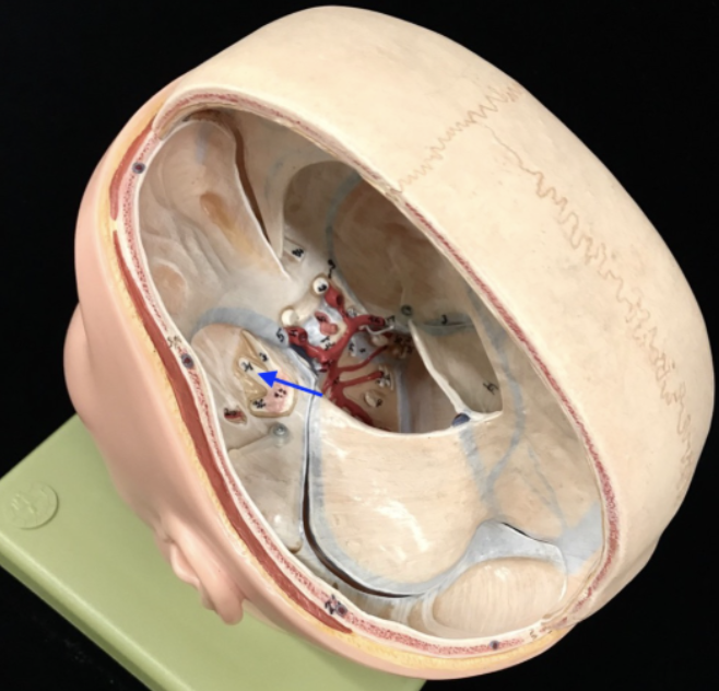 <p>What is the name of the cranial nerve (and roman numeral) and its branch?</p>