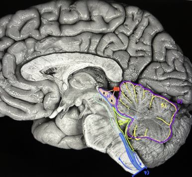 <p>What is the red?</p>