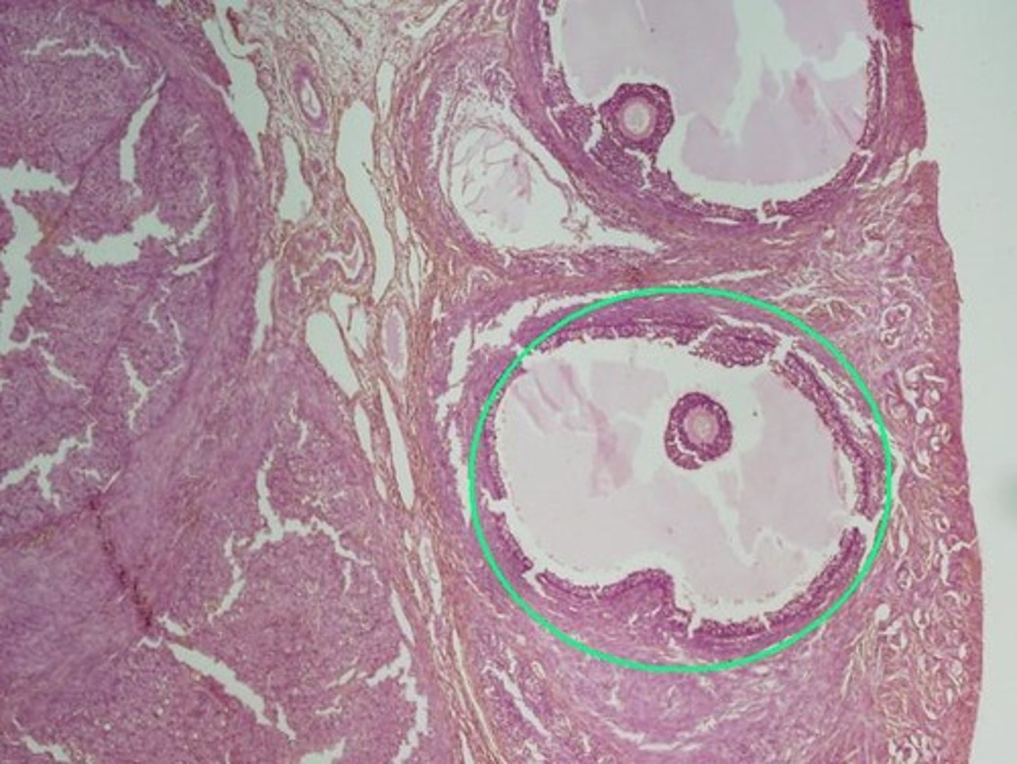 <p>granulosa cells</p>