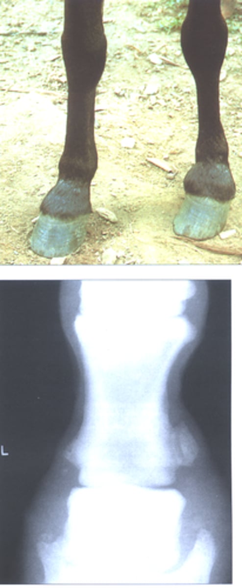 <p>New bone growth that occurs on the proximal, middle, or distal phalanx</p><p>Most commonly on forelimbs, but can occur on hindlimbs</p><p>Causes: Poor conformation, heavy work for years, excessive pulling on ligaments --&gt; disruption of periosteum</p><p>Classified by location on bone or by joints involved (high, low, periarticular, or articular)</p><p>Articular always causes lameness (involves joint surface)</p>