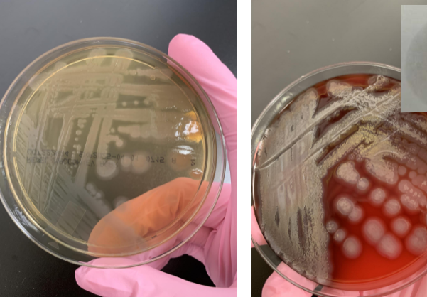 <p>lets say your oxidase is positive and it’s also motile, what organism is this</p>
