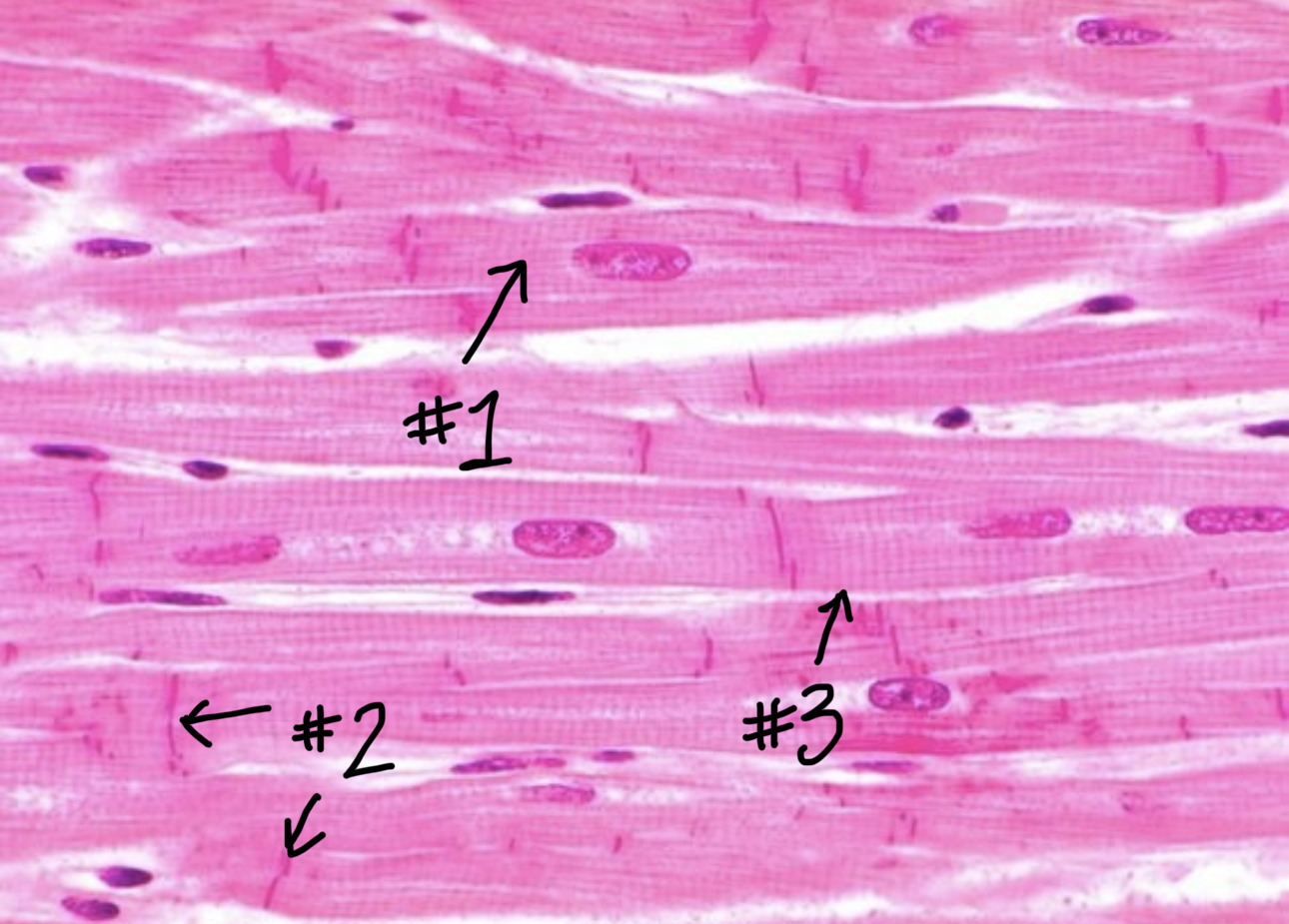 \#3 (located on a muscle fiber)