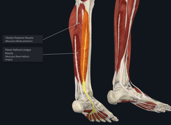 <p>name the yellow highlighted muscle </p>