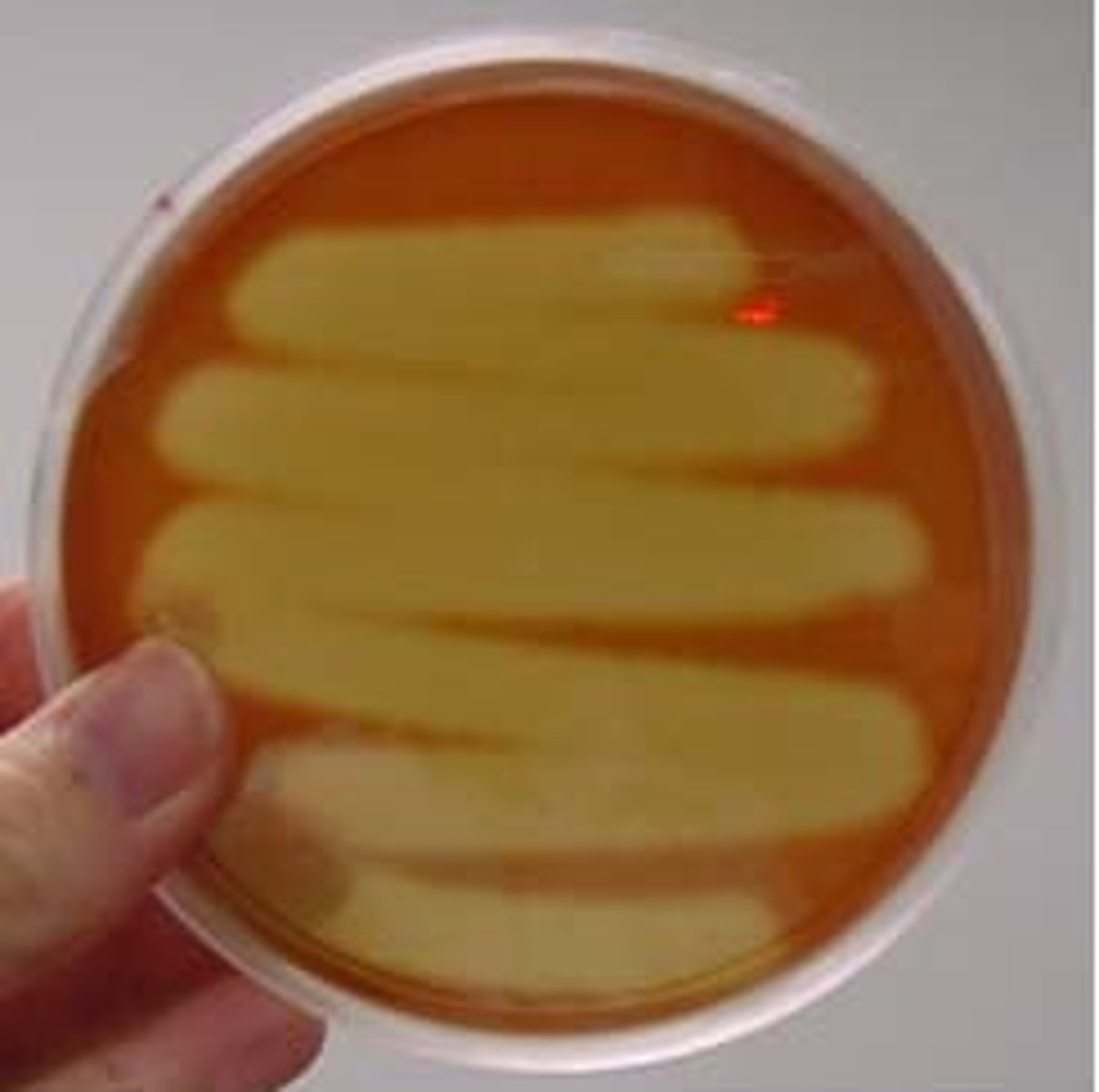 <p>complete breakdown of hemoglobin</p>