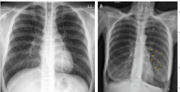 <p>What is going on in these pictures. Whats the dx?</p>