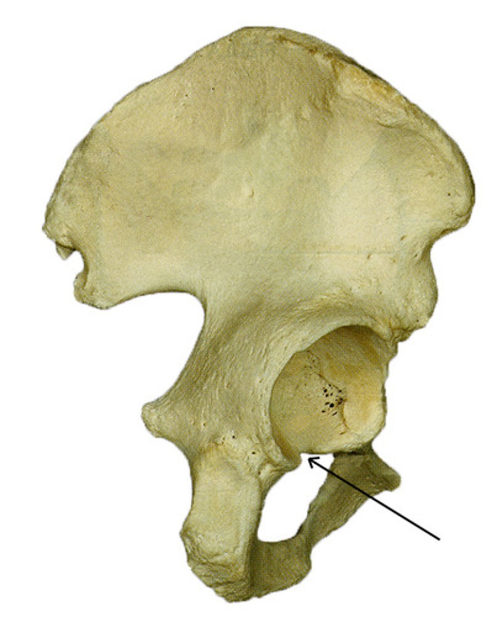 <p>Name the structure.</p>