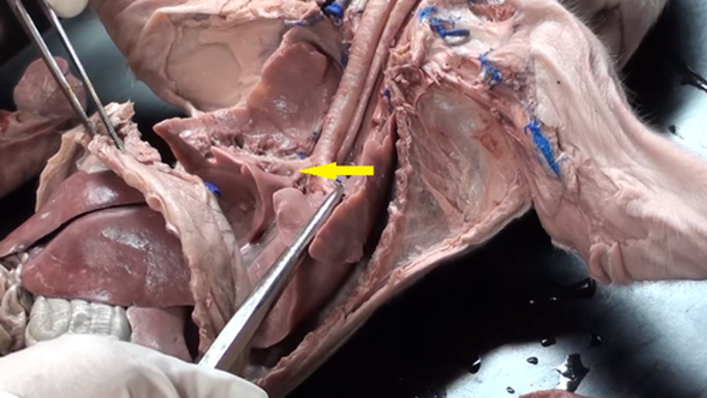 <p>Right primary bronchus</p>