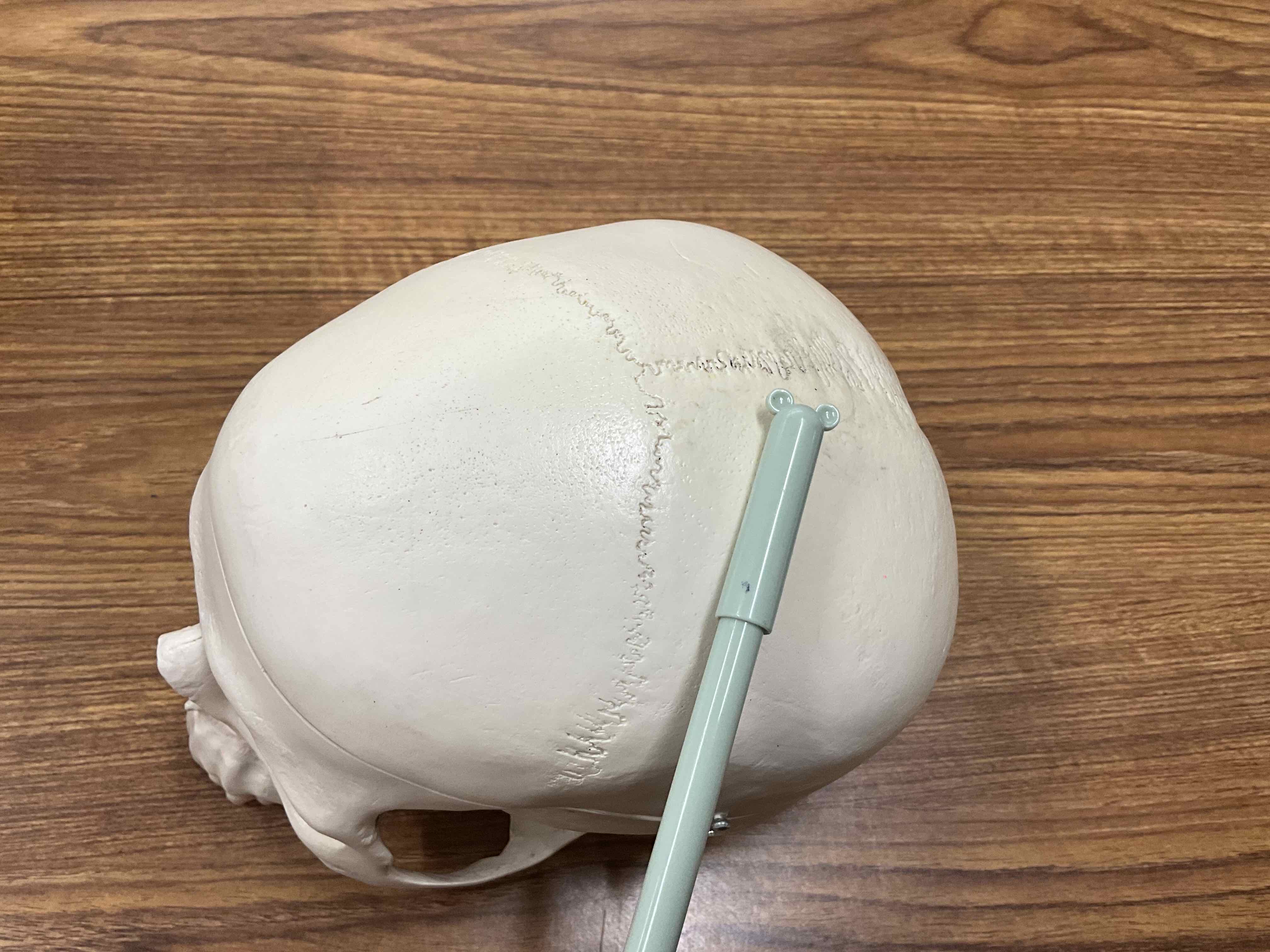 <p>Suture</p>
