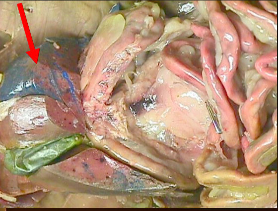 <p>one of the most important organs</p>