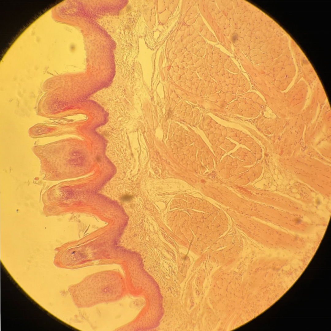 term image