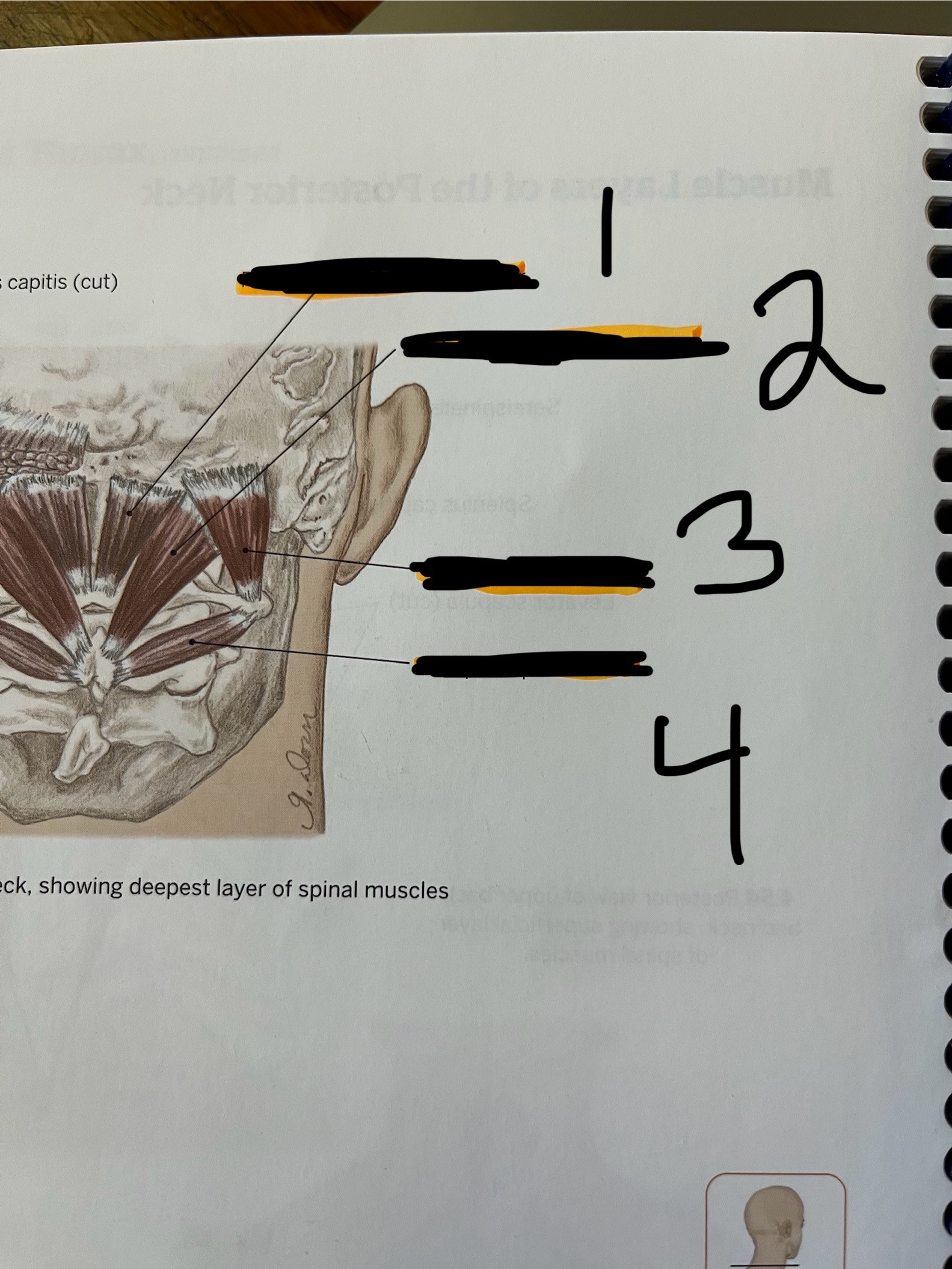 <p>What muscle is number 3</p>