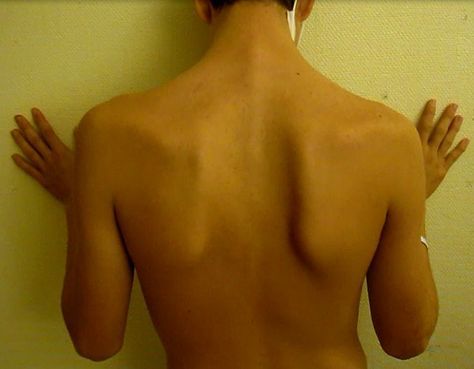 <p>Shoulder blades</p>