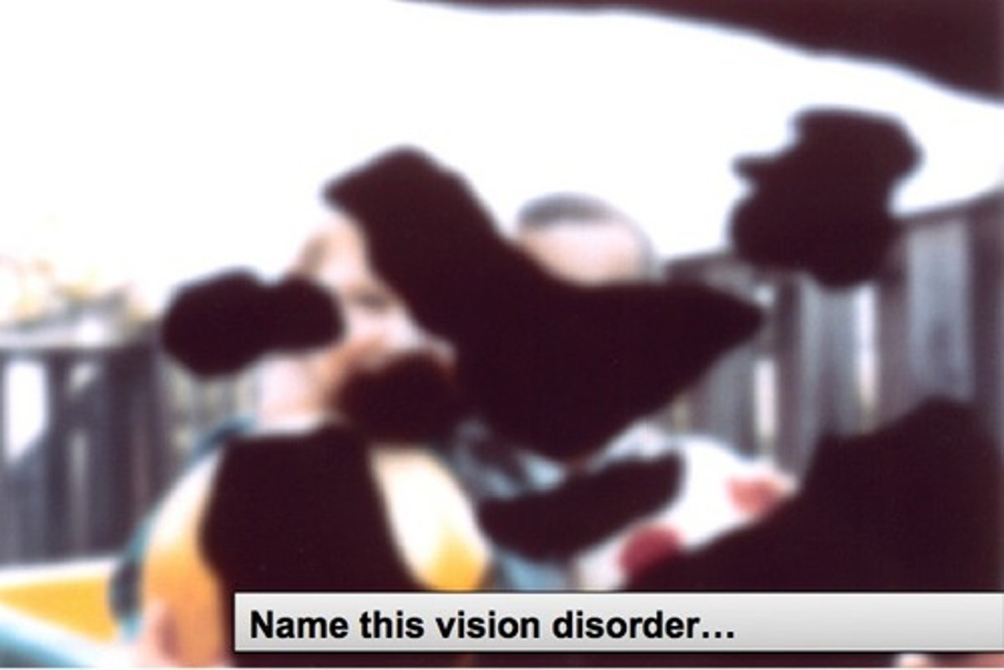 <p>small unstable blood vessels develop inside the eye that ruptures and creates blind spots</p>