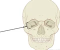 <p>The eye socket, made up of the maxilla and zygoma.</p>