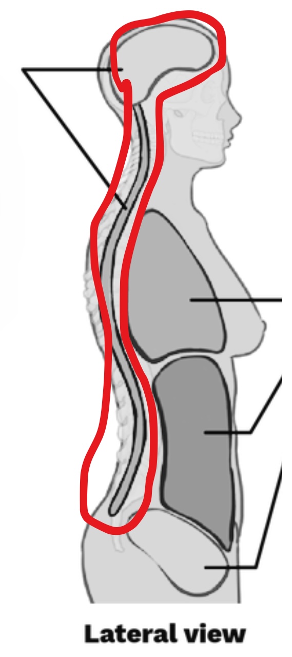 <p>What cavity is this?</p>
