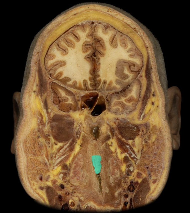 term image
