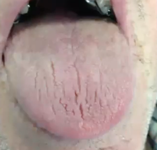<p>What is the diagnosis</p>