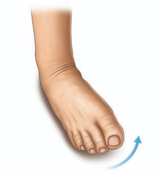 <p>inward turning of the foot at the ankle </p>