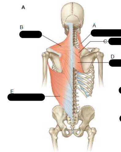 <p>A.</p>