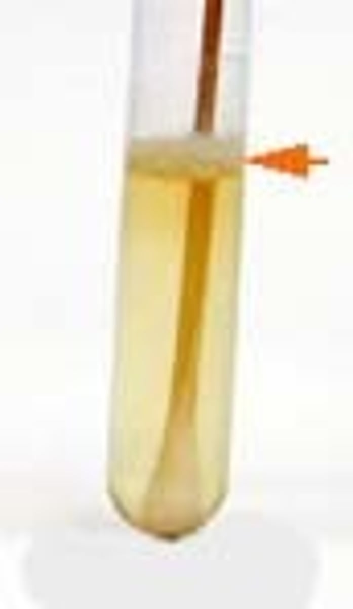 <p>Growth forms film on surface.</p>