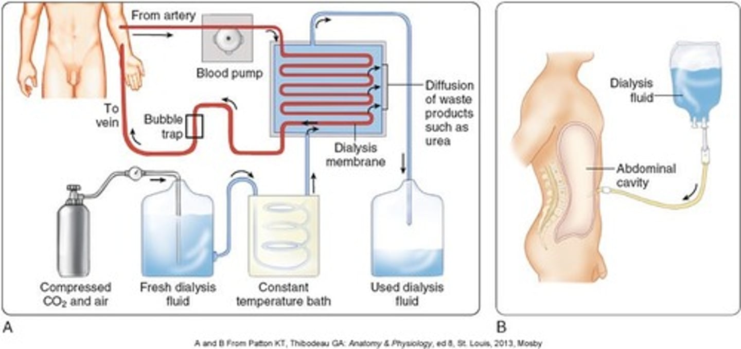 <p>Treatment process for patients with advanced and permanent kidney failure. This process removes blood from the body, cleanses the blood, and returns it to the body. Patient must attend 3x/week for 3-5 hours at a time.</p><p>Side effects may include anemia, pruritus, sleep disorders, and amyloidosis (amyloid deposits in organs and tissue)</p>