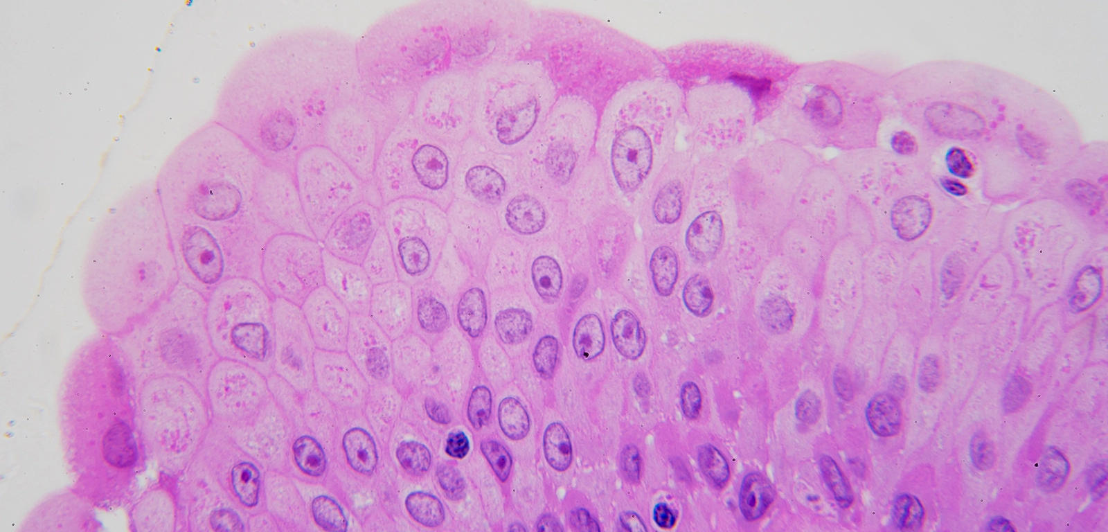 <p>Transitional Epithelium </p>