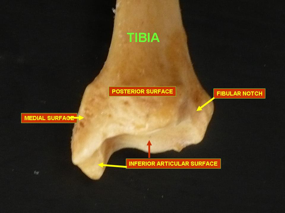 <p>distolateral corner of the TIBIA</p>