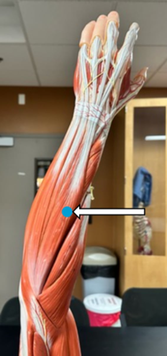 <p>extensor digitorum (function)</p>