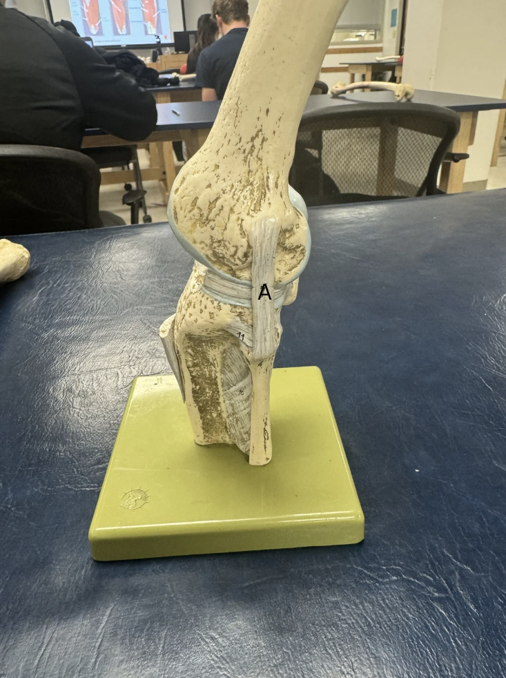 <p>Label this Ligament</p>