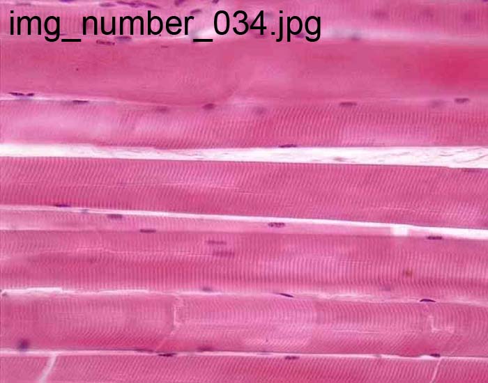 <p>Striated (skeletal) muscle</p>